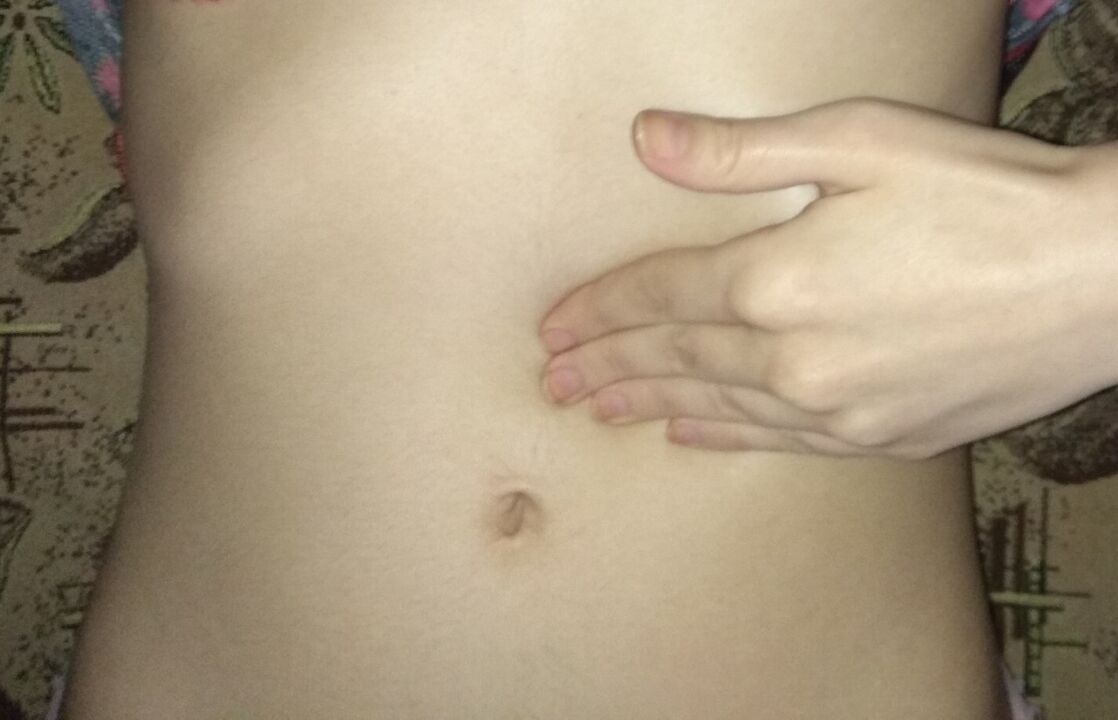 Estômago saudável após tratamento com cápsulas de NEOflorax