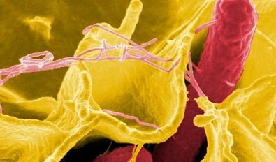 Sinais de parasitas no corpo humano