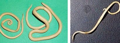 quais parasitas uma pessoa pode ter