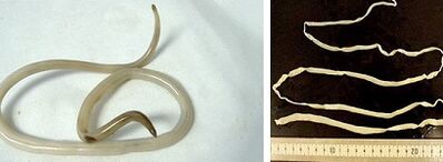 tipos de parasitas no corpo humano