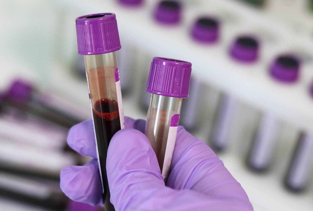 exame de sangue para parasitas